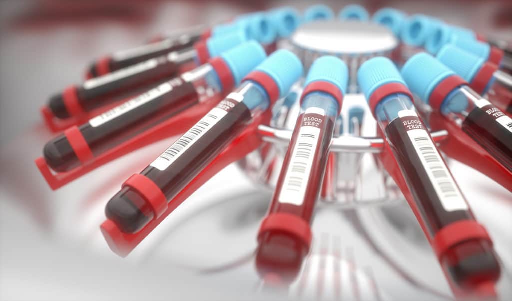 Blood test for thyroid hormones